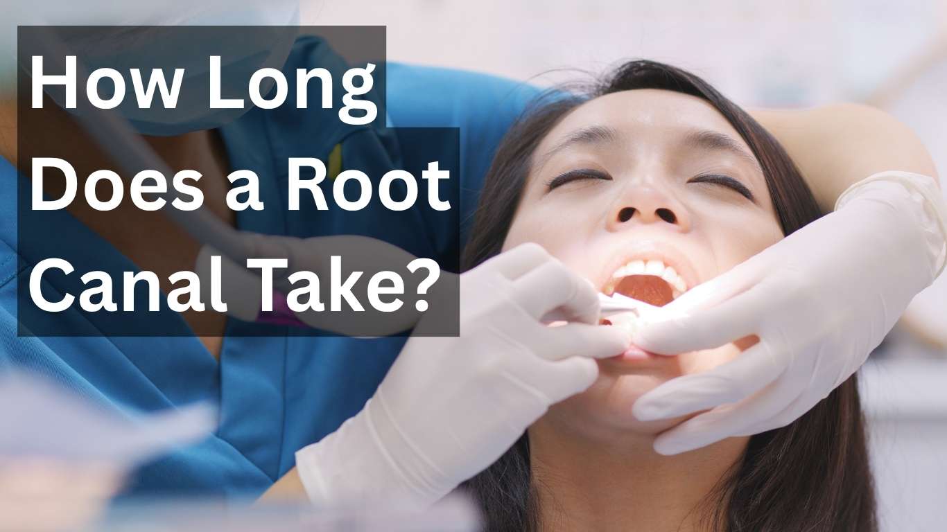 How Long Does a Root Canal Take